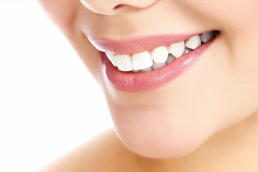 Teeth Whitening Near Me: What Are the Benefits of Teeth Whitening?