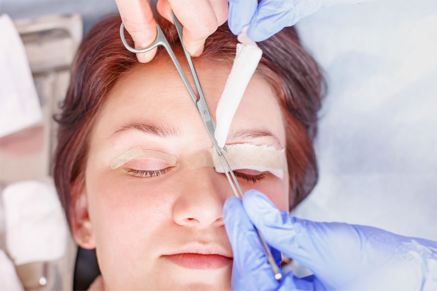 The Pros and Cons of Getting a Blepharoplasty